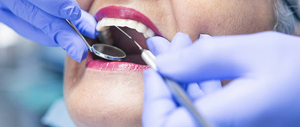 Best Emergency Dental Care for Abscessed Tooth in Escobares, TX